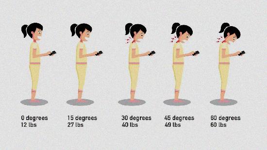 Forward Head Posture/ Text Neck Syndrome