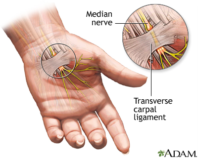 Location Of The Carpal Tunnel